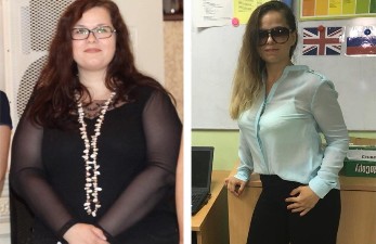pozele pierderii în greutate înainte și după